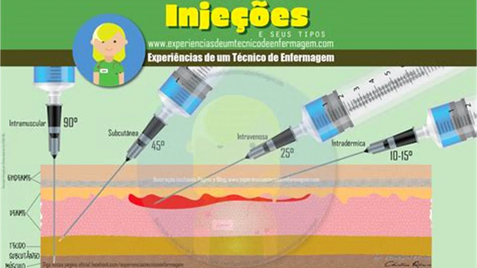 Como usar Ozempic — aplicação da caneta de semaglutida subcutânea